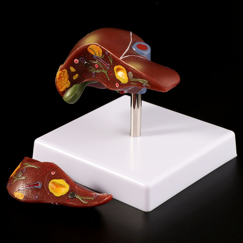 Human Liver Pathological Anato - Medical Lab Technology 评论和价格