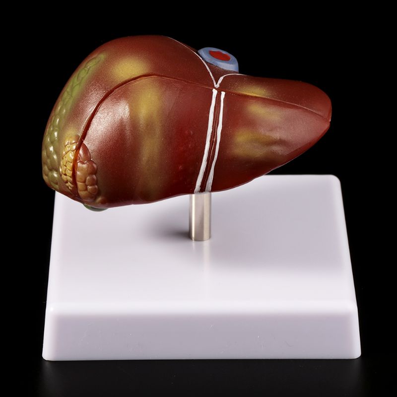 Human Liver Pathological Anato - Medical Lab Technology 评论和价格