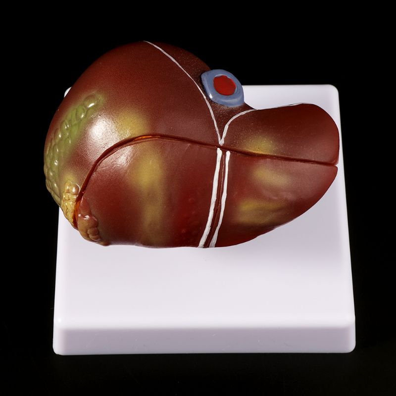 Human Liver Pathological Anato - Medical Lab Technology 评论和价格