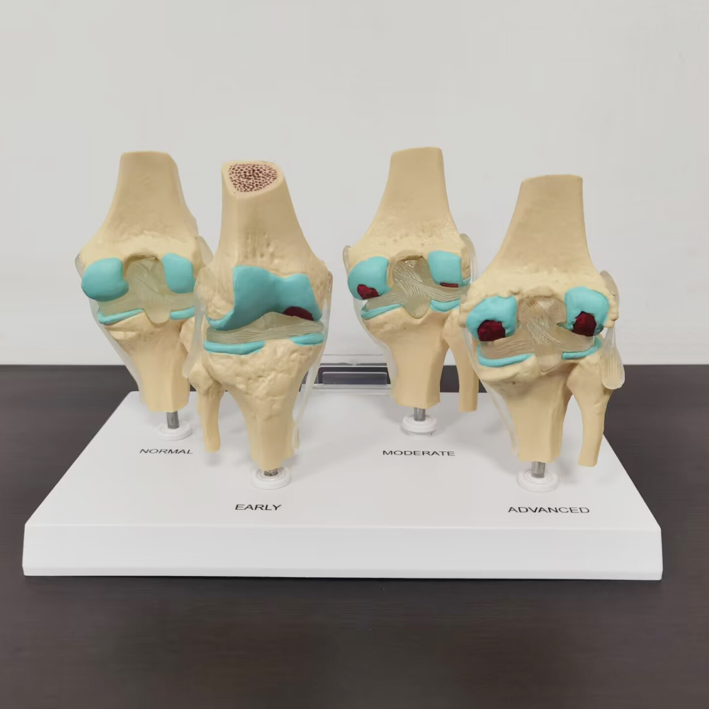 4-stage knee joint model Plast - Medical Lab Technology 评论和价格