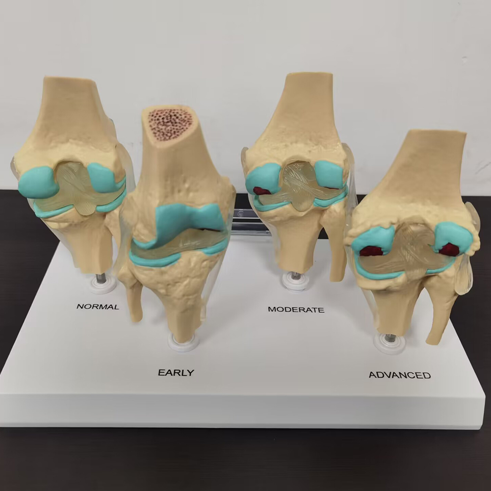 4-stage knee joint model Plast - Medical Lab Technology 评论和价格