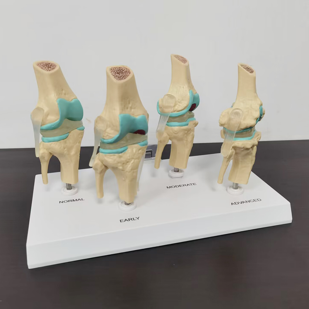 4-stage knee joint model Plast - Medical Lab Technology 评论和价格